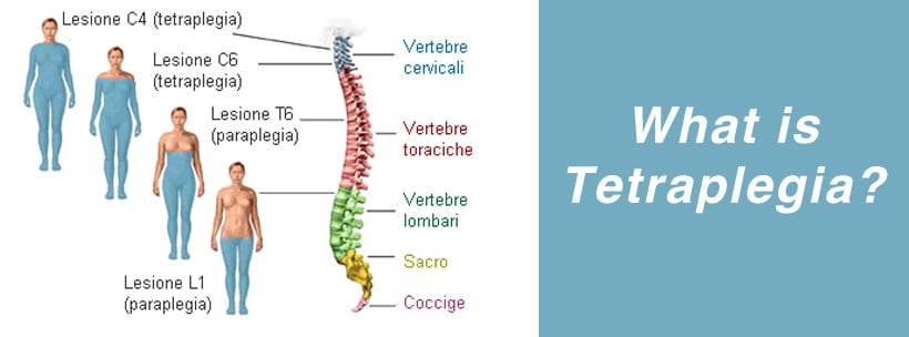 Image result for Tetraplegia